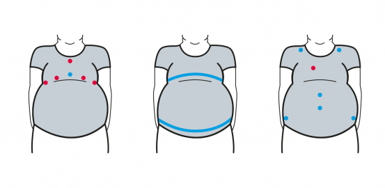 ObeSense: un t-shirt «intelligent» pour combattre l’obésité